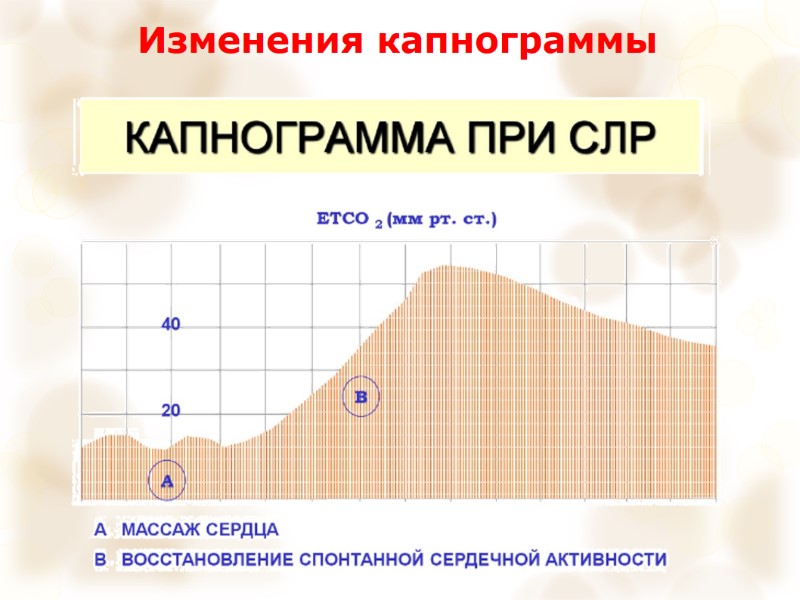 Изменения капнограммы